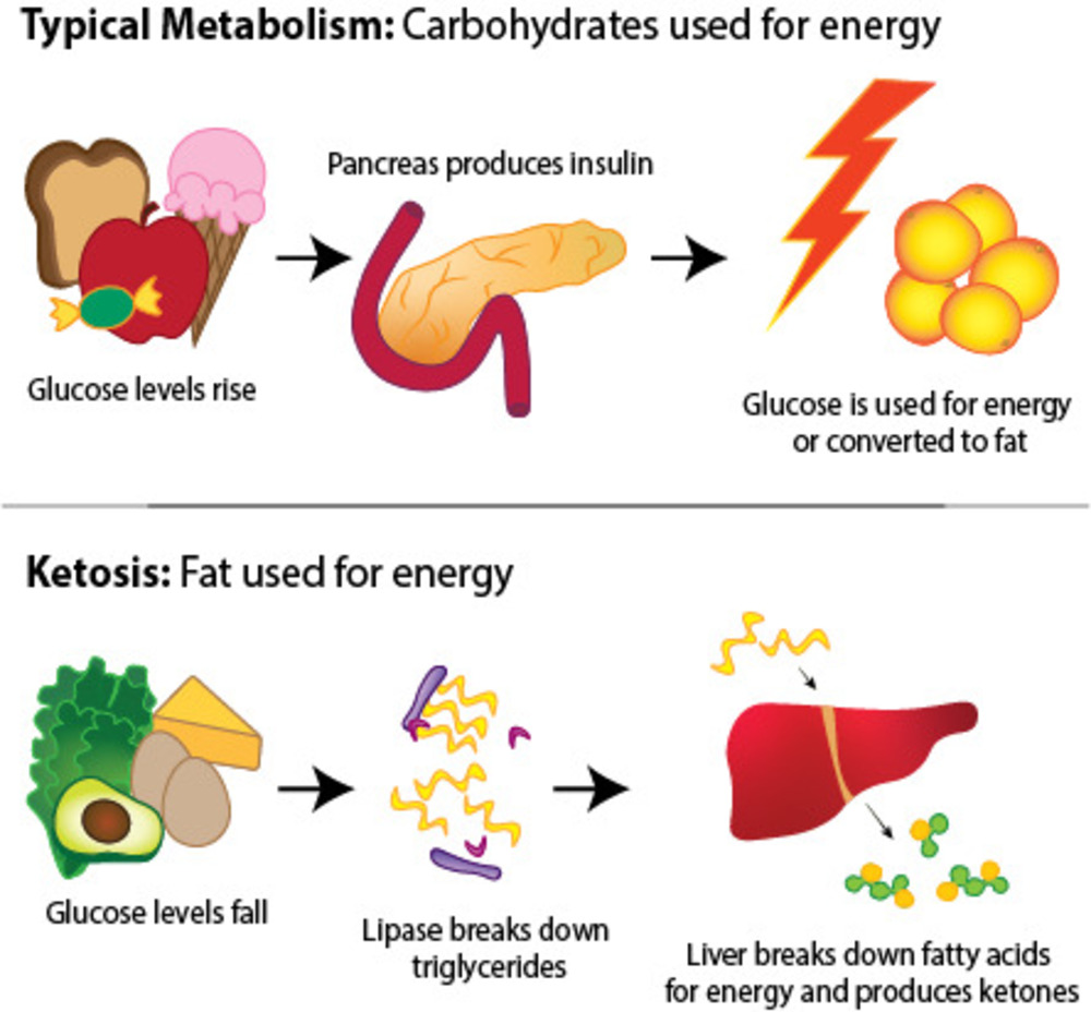 ketosis